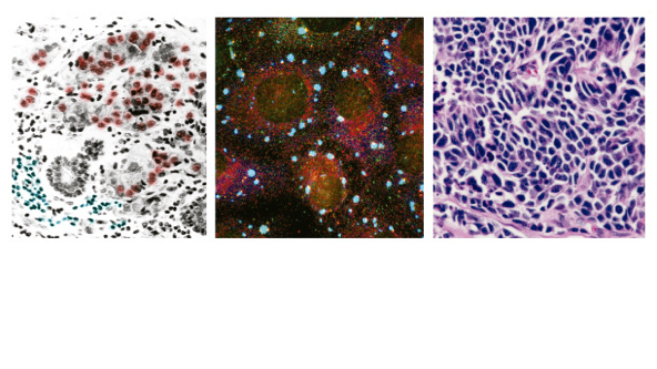 Cristina Saez Torres